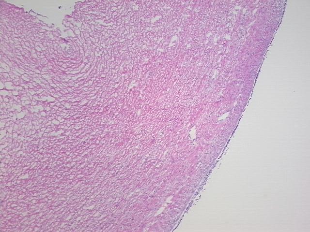 4x Image