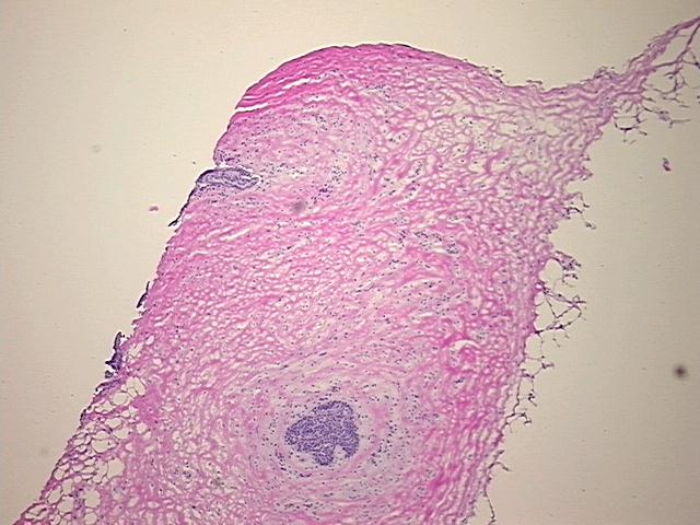 4x Image