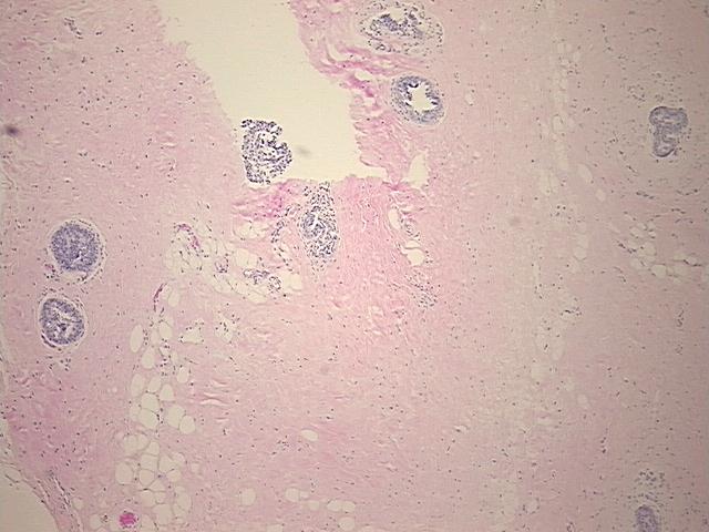 4x Image
