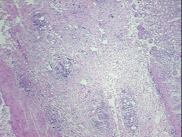 4x Image