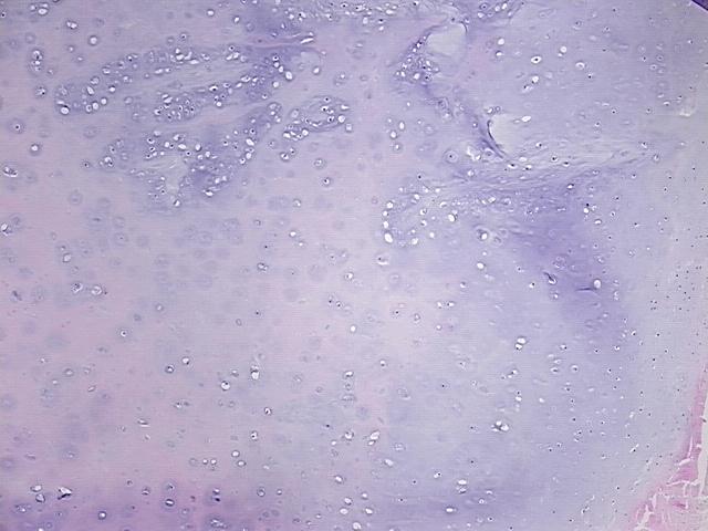 4x Image