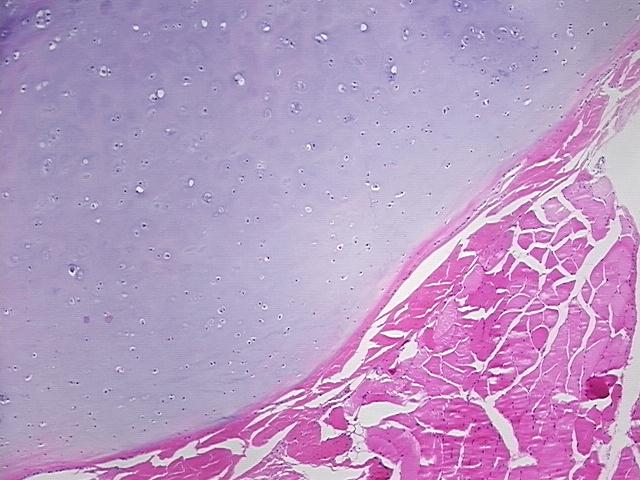 4x Image