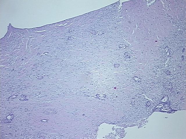 4x Image