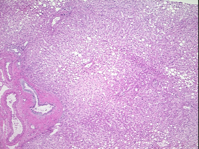 4x Image