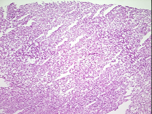 4x Image