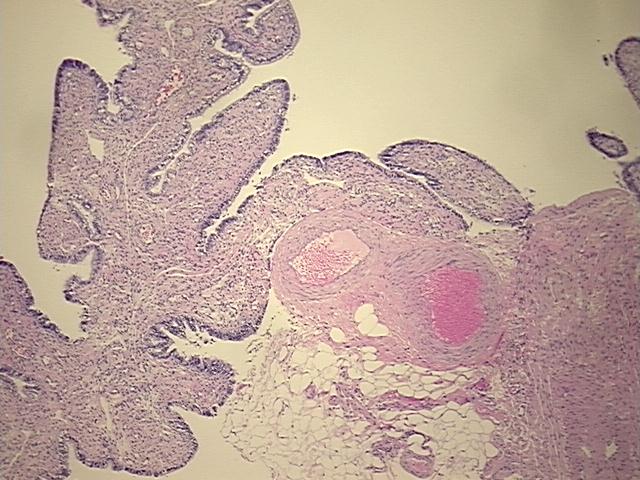 4x Image