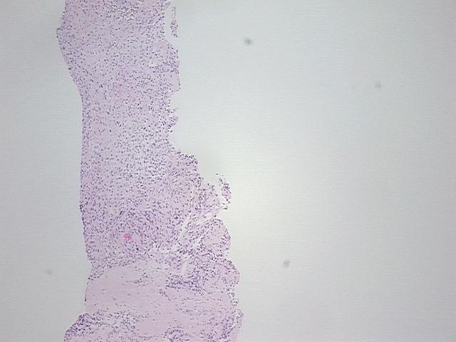 4x Image