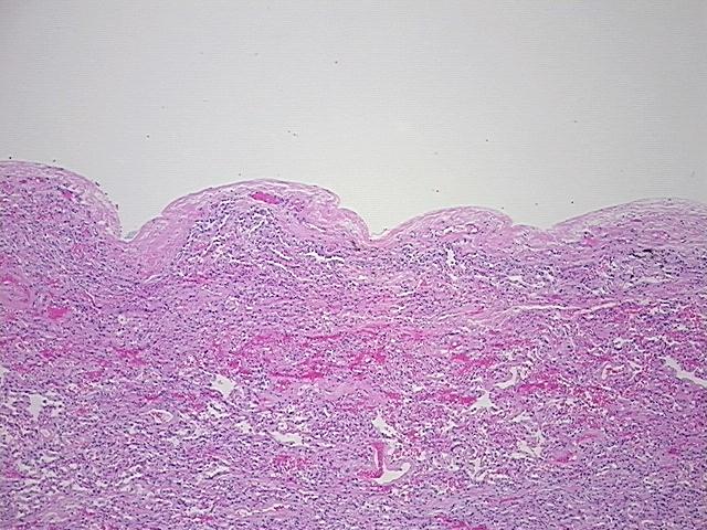 4x Image