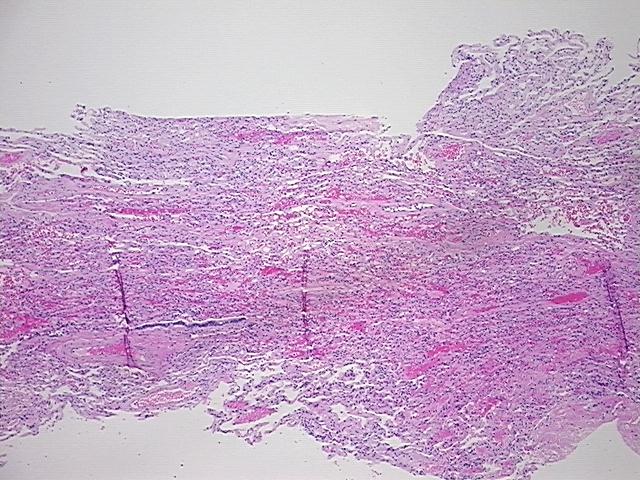 4x Image