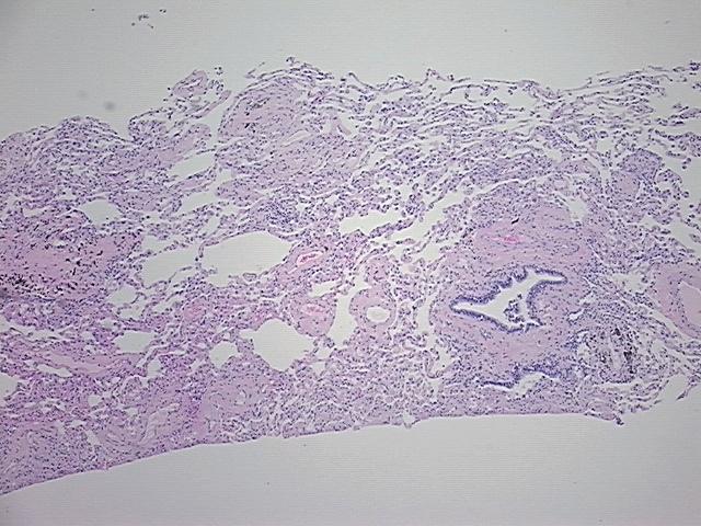 4x Image