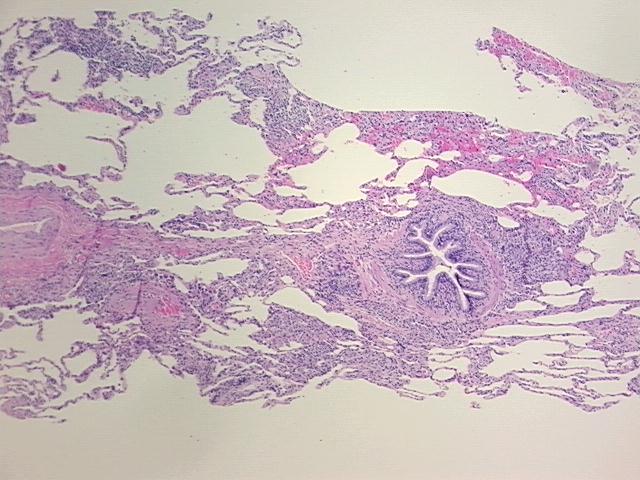 4x Image