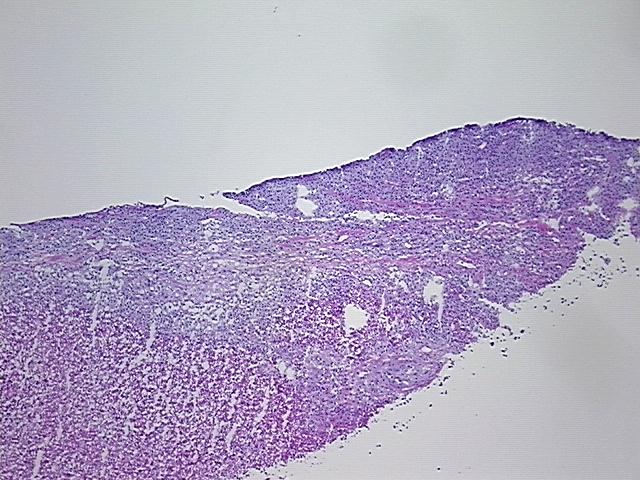 4x Image