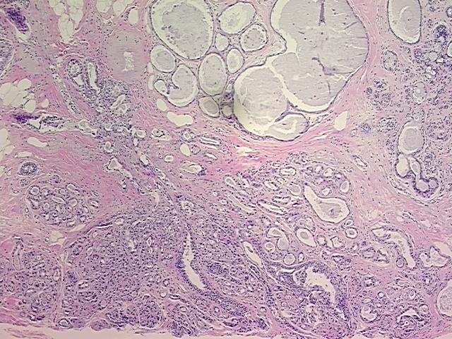 4x Image