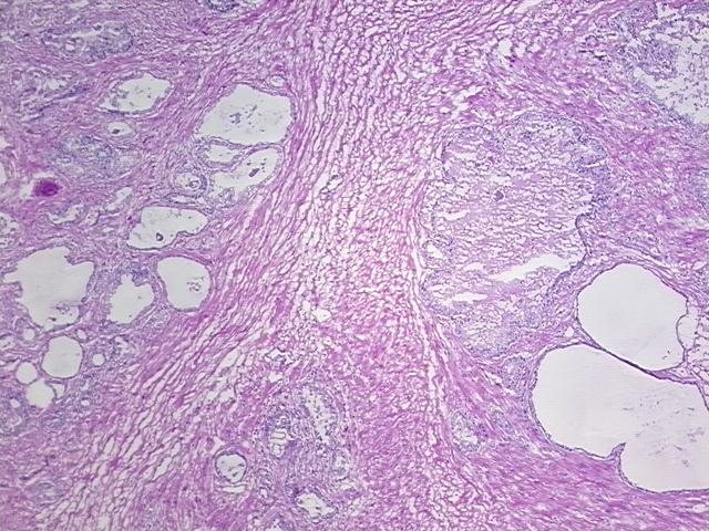 4x Image