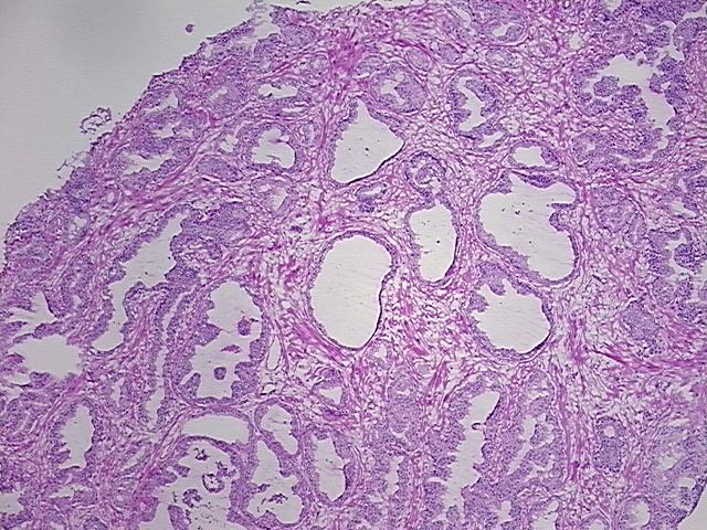 4x Image