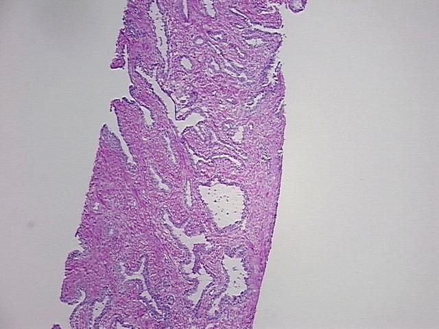 4x Image