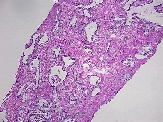 4x Image
