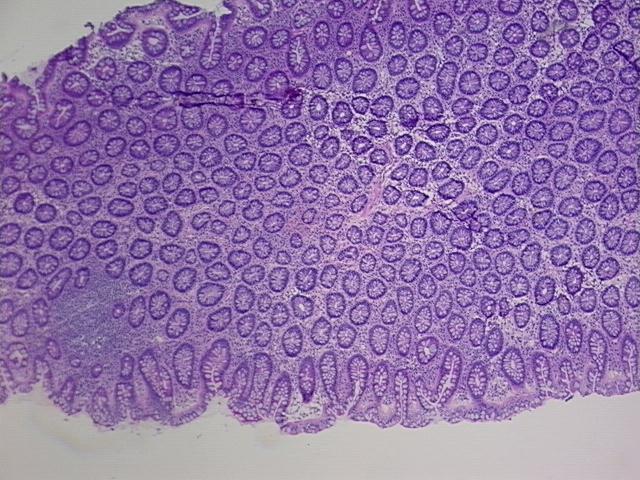 4x Image