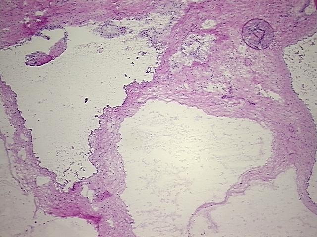 4x Image