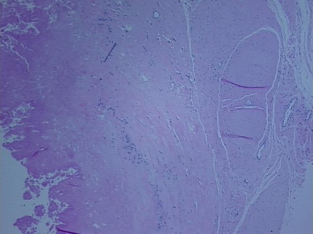 4x Image