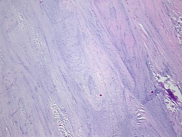 4x Image