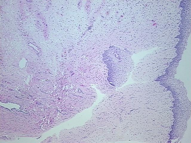 4x Image