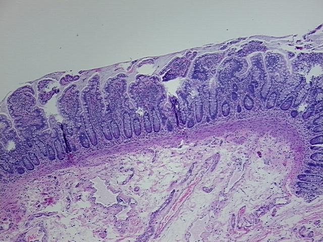 4x Image