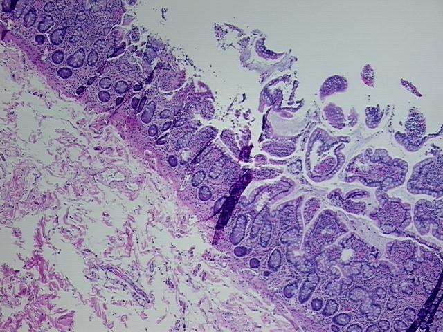 4x Image