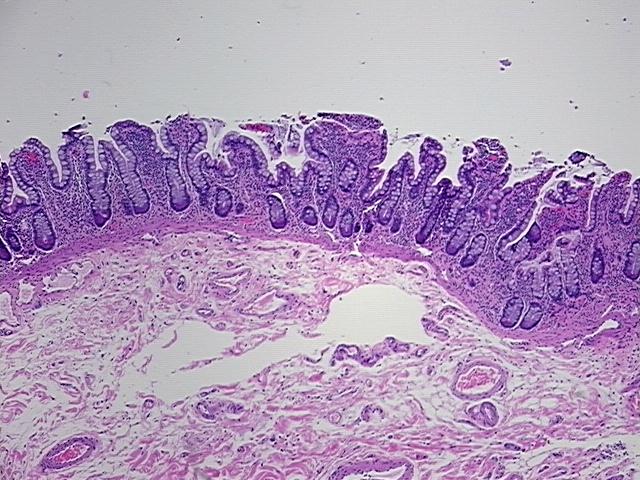 4x Image