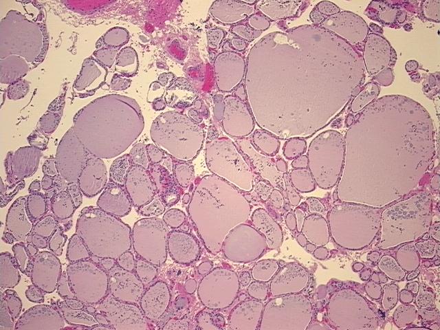 4x Image