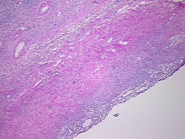 4x Image