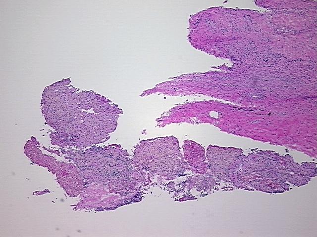 4x Image