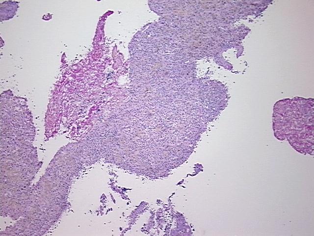 4x Image