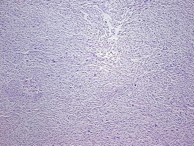 4x Image