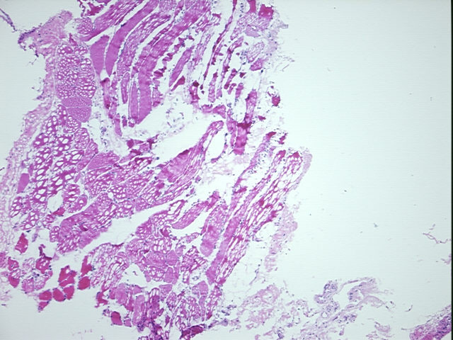 4x Image