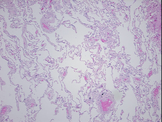 4x Image