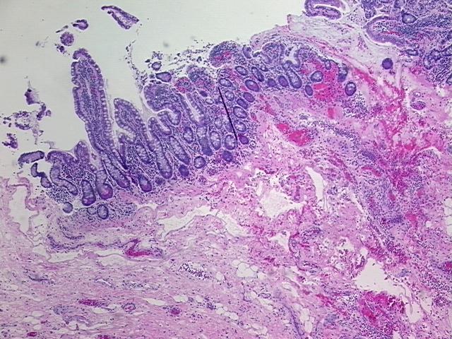 4x Image
