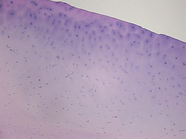 4x Image