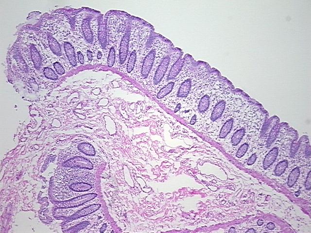 Tissue Sections (5x5um), Frozen; Colon; Within normal limits