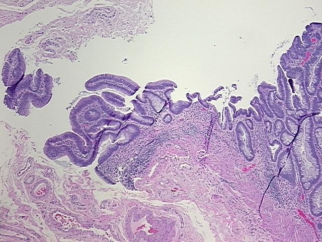 4x Image