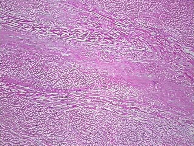 Frozen Tissue Sections, Tendon