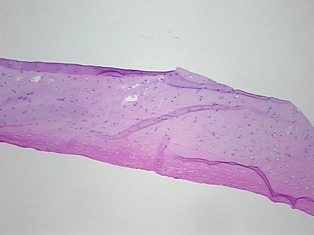 4x Image