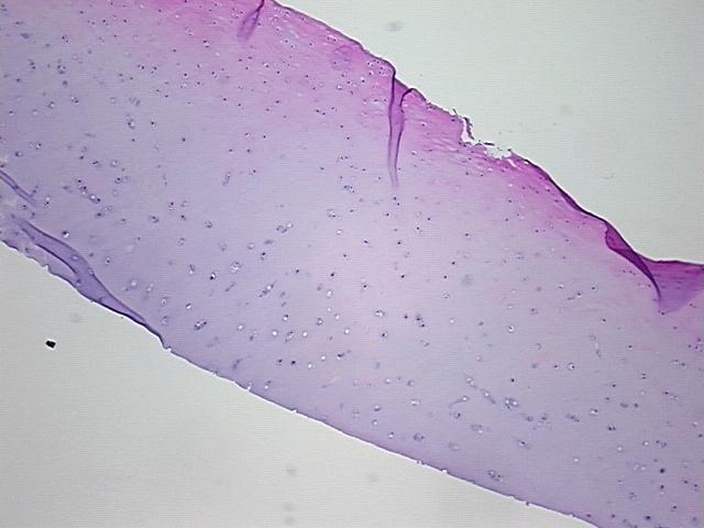 4x Image
