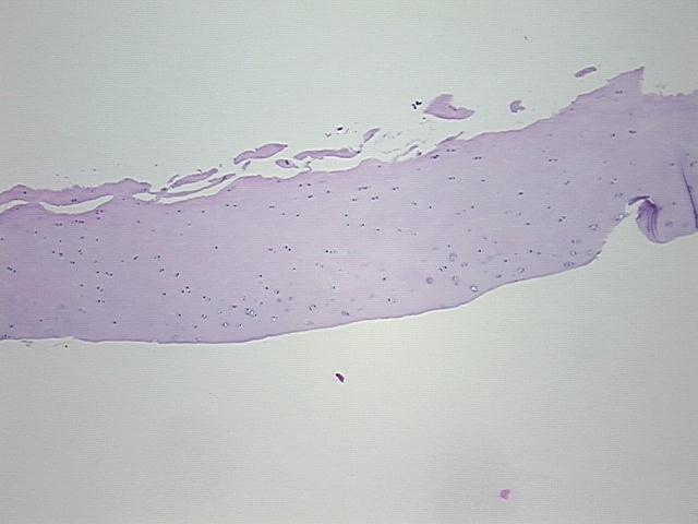 4x Image