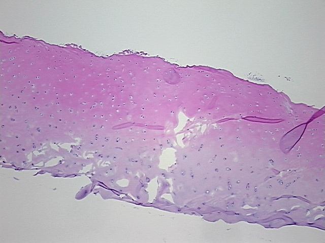4x Image