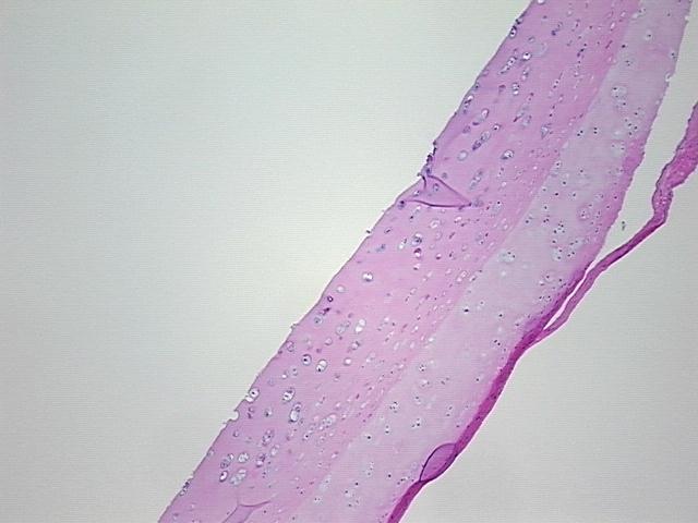 4x Image