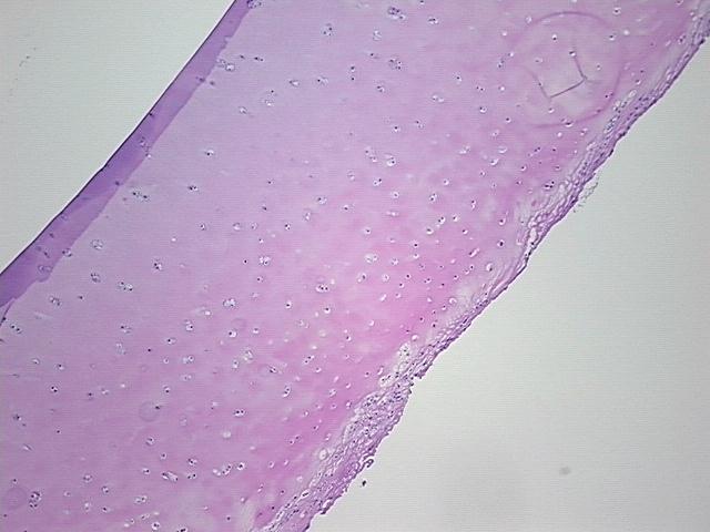 4x Image