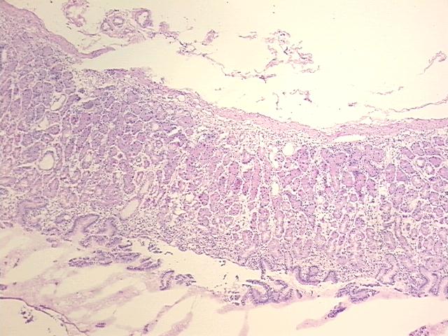 4x Image