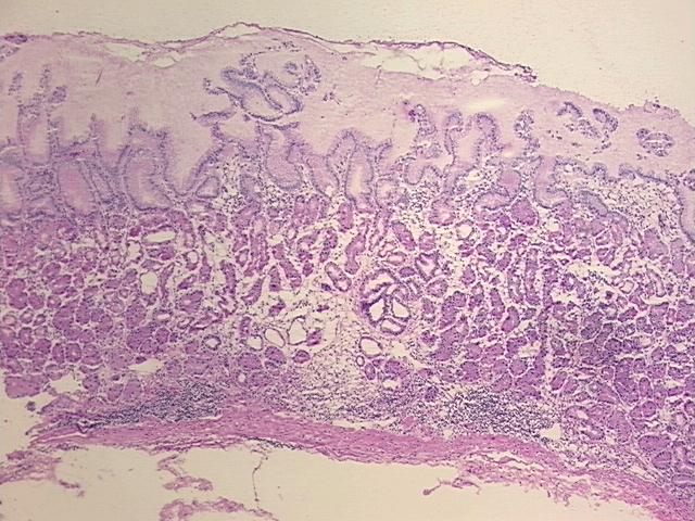 4x Image