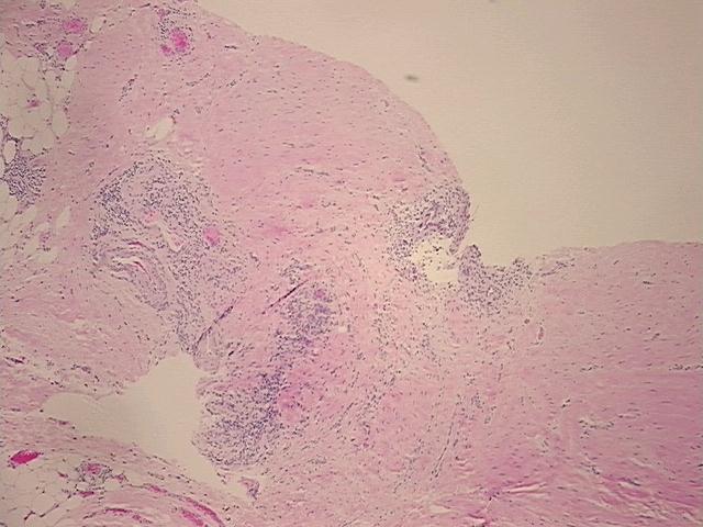 4x Image